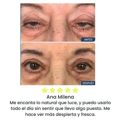 Eyelid KIT X120 | Levanta Párpados Instantáneo