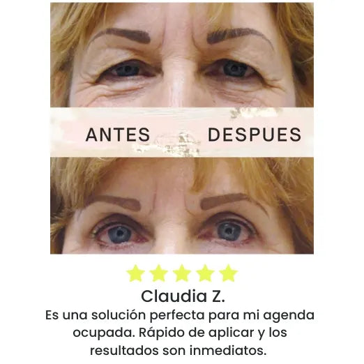 Eyelid KIT X120 | Levanta Párpados Instantáneo